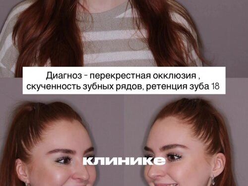 Система