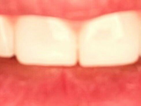 Tr-dental