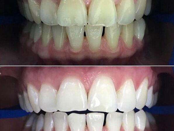 Астра- Дентал