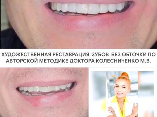 Beauty Line