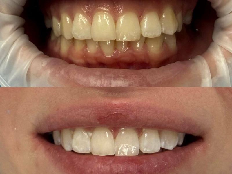 MoonLight Dental Gallery