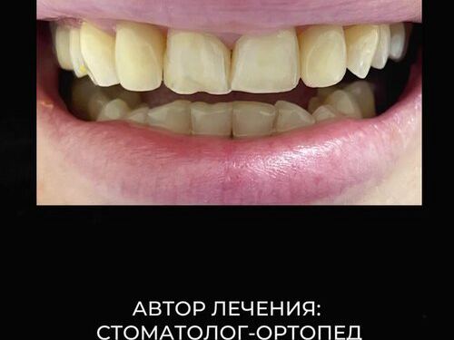 АО Стом