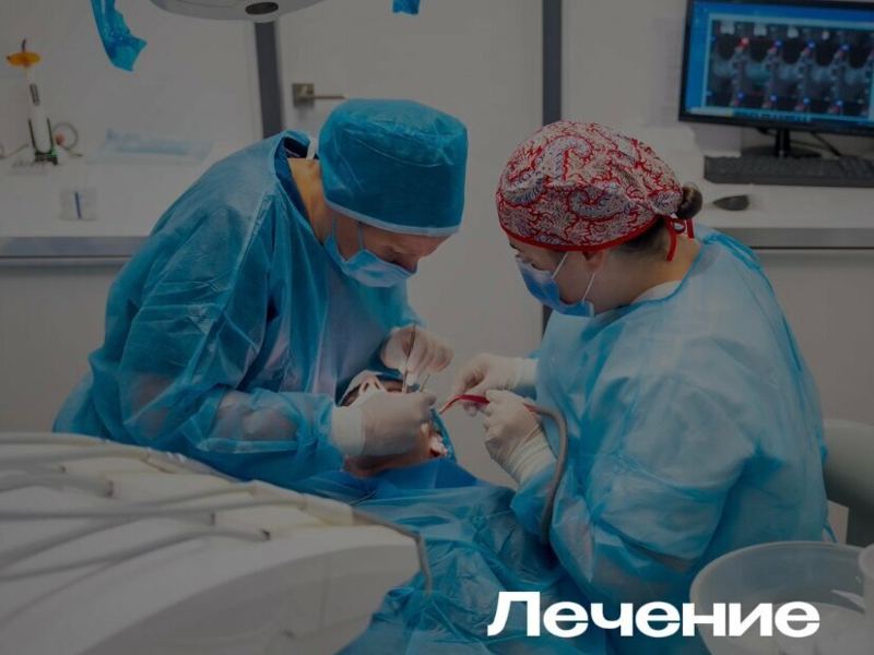 Аксон