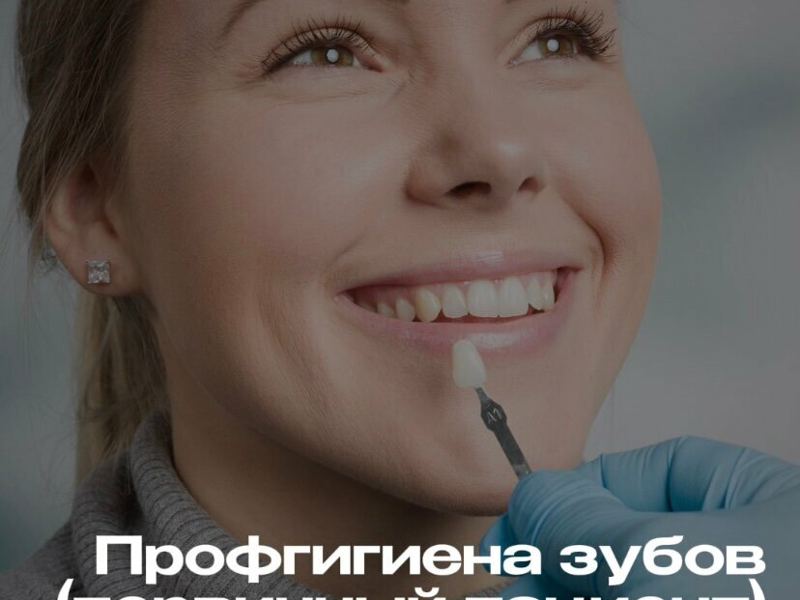 Аксон