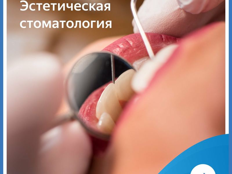 Аполлония
