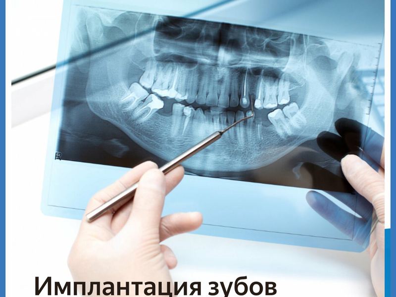 Аполлония