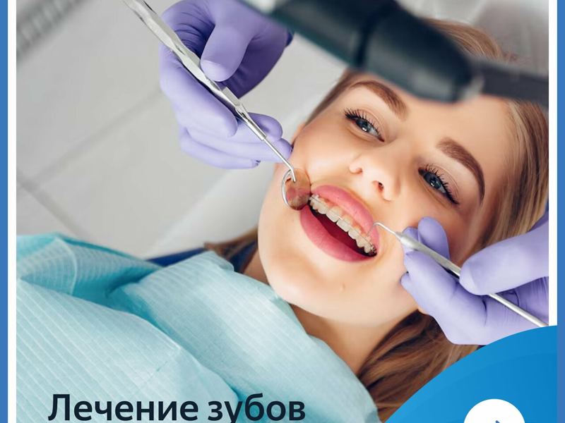 Аполлония