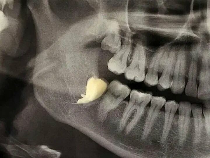 Happy Dental