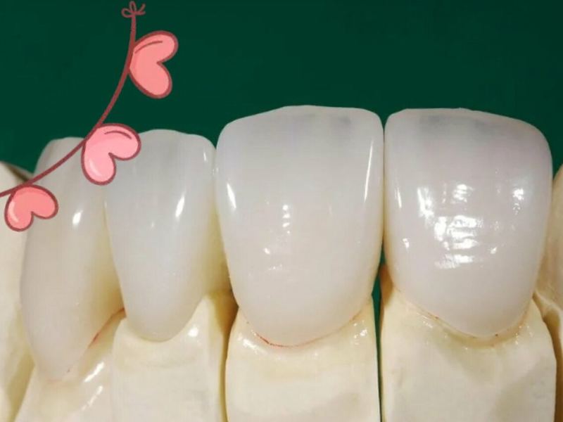 Happy Dental