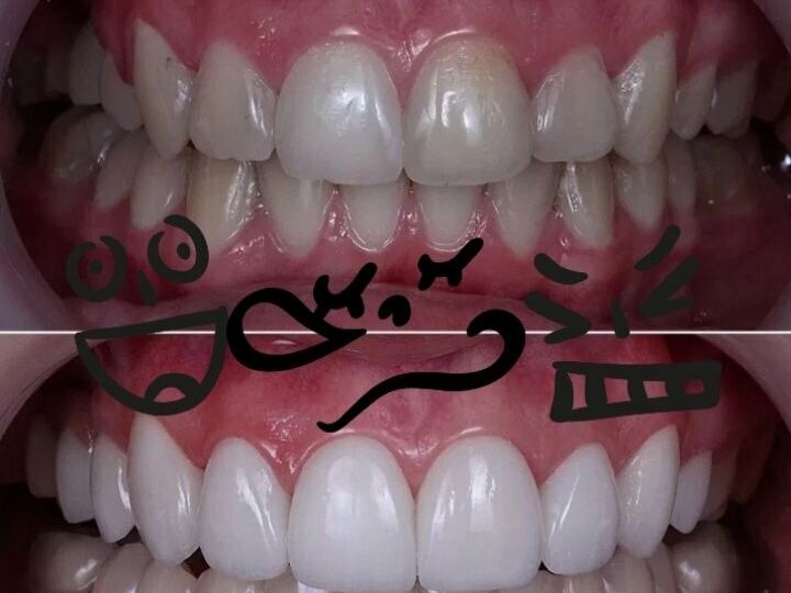 Happy Dental