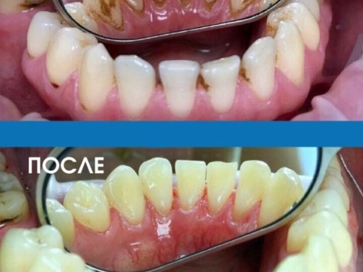 Happy Dental