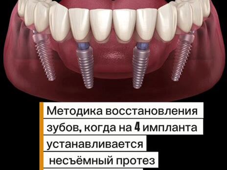 Дофамин