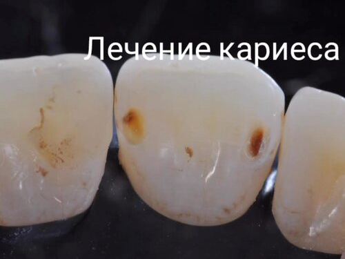 Алисар