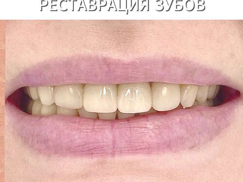 Просмайл. ру