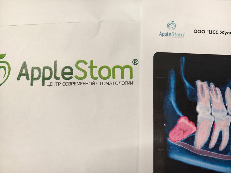 AppleStom
