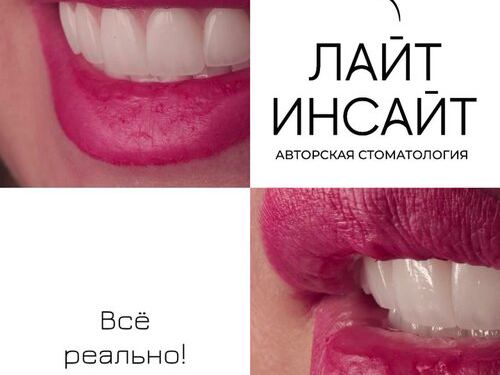 Лайт Инсайт