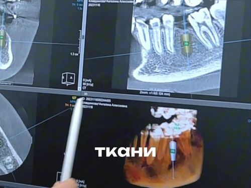 Зуб. ру