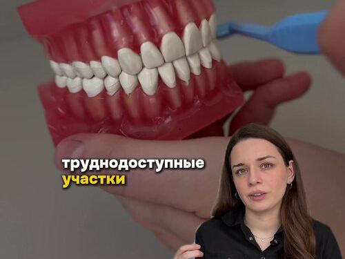 Денткор