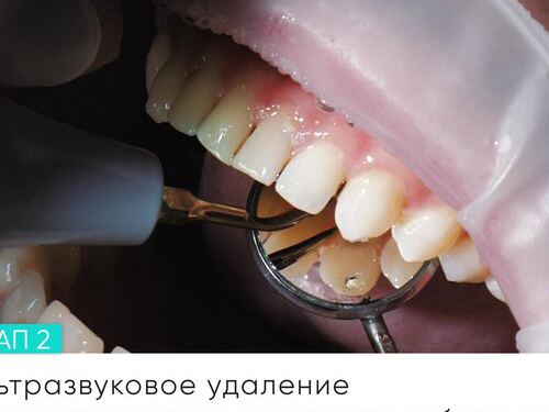 Бест Клиник