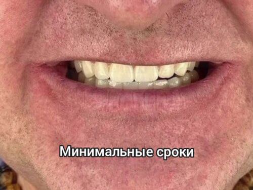 Дентал Круиз