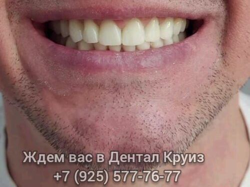 Дентал Круиз