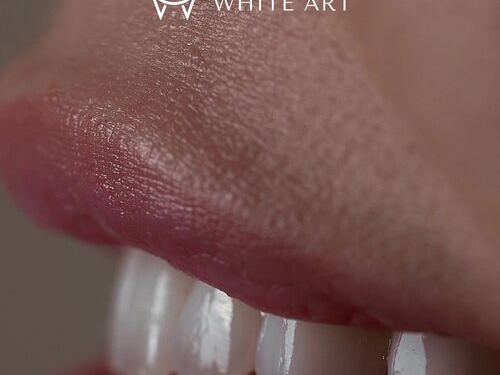 White Art