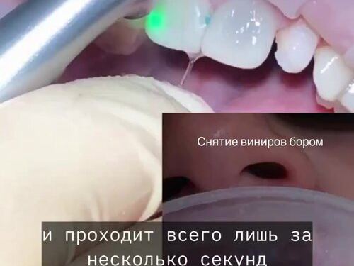 Эстетик Дент
