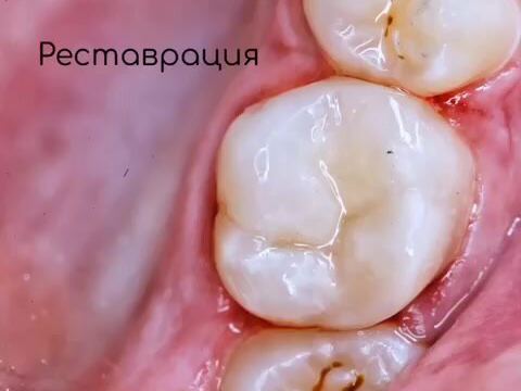 Андент