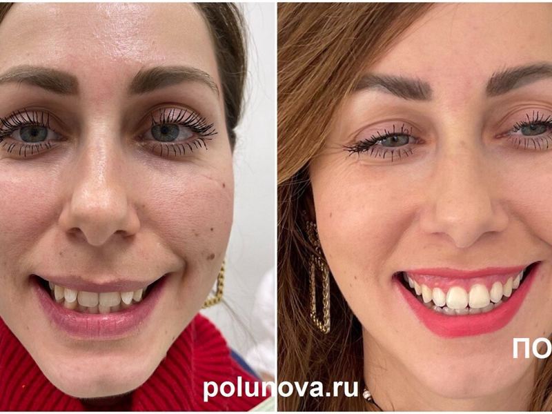 Ортодонт-центр Ортодонтика