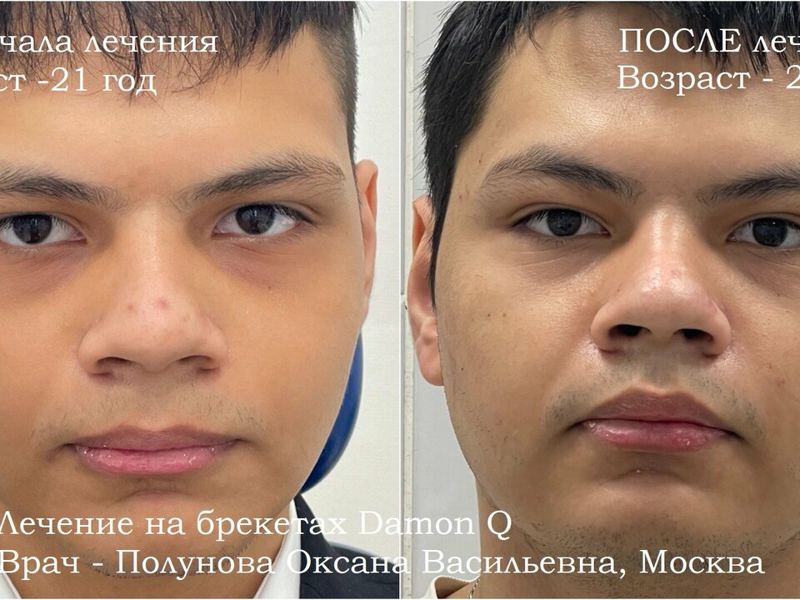 Ортодонт-центр Ортодонтика
