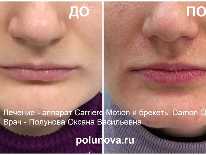 Ортодонт-центр Ортодонтика