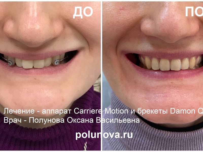 Ортодонт-центр Ортодонтика