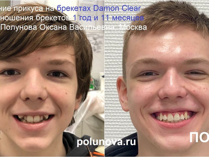 Ортодонт-центр Ортодонтика