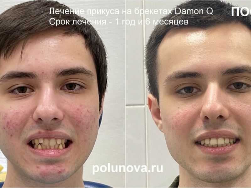 Ортодонт-центр Ортодонтика
