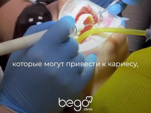 Бего
